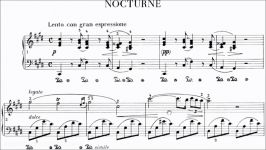 ABRSM Piano 2017 2018 Grade 7 B1 B1 Chopin Nocturne in C# Minor Op.Posth KK Iva No.16 Sheet Music