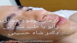 درمان تومور همونژیوم کاورنو  دکتر زهرا شاه حسینی