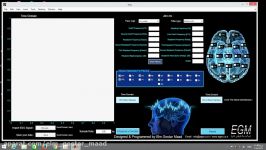 EEG GUI ELM GOSTAR MAAD