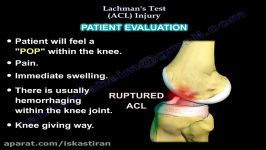 Lachmans Test ACL Injury  Everything You Need To Know  Dr. Nabil Ebraheim