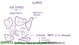 انیمیشن کوتاه کامل در رابطه Lupus nephritis