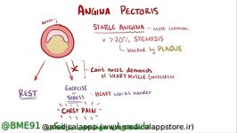 انیمیشن کوتاه کامل در رابطه angina pectoris