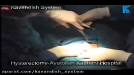 عمل جراحی Hysterectomy