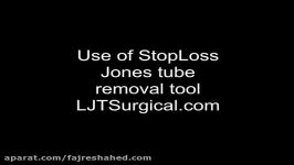 StopLoss Jones tube Removal tool