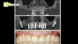 نمایشگاه کنفرانس دندانپزشکی دبی را دست ندهید