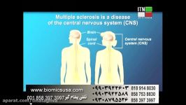 درمان ام اس سلولهای بنیادی به روش دکتر وزیری تبار؟