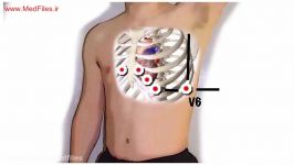 آموزش گرفتن نوار قلب ECG 12 لید