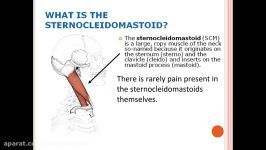 Head Eye and More Pain from Sternocleidomastoid Muscle Trigger Points Referred Pain Patterns