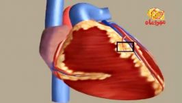 mi  سكته قلبی