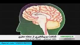 علایم مهم سکته مغزی، پیشگیری درمان سکته مغزی