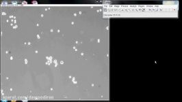 Counting Cells with ImageJ