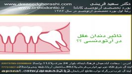 تاثیر دندان عقل در ارتودنسی دکتر سعید قریشی