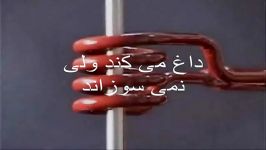 داغ می کند ولی نمی سوزاند