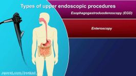 آموزش ERCP   آندوسکوپی 