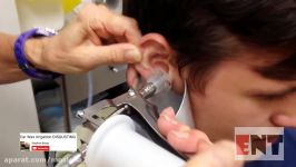 EAR WAX Removal techniques