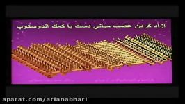 آزادکردن عصب میانی دست کمک آندوسکوپ.flv