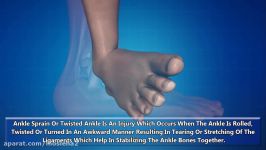 Treatment for Ankle Sprain or Twisted Ankle