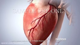 Acute Coronary Syndrome and Heart Attack