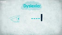 خوانش پریشی یا Dyslexia