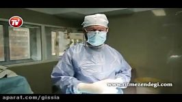 یک ویدئوی دیدنی جراحی سنگین افتادگی پلک چشم در اتاق عمل بیمارستان ساسان تهران