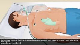 Tension Pneumothorax Simulation