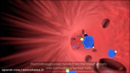 PET Scan animation