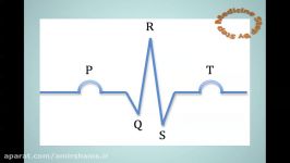 Understanding ECGs EKG 