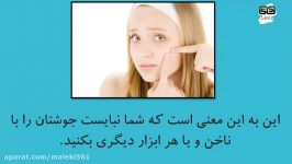 راه دفاع چگونگی بین بردن آکنه حافظ پارور