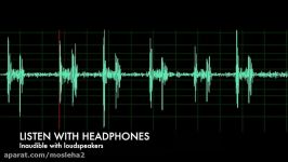 Pulmonary Associated Heart Sounds Tricuspid Regurgitation