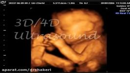 The 3d 4d Ultrasound Experience at Goldenview Ultrasound Chicago BostonNYC