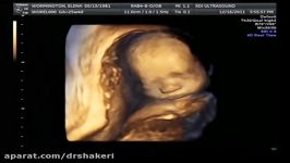3D ultrasound 25 weeks 4D view of baby 25 week pregnancy baby girl first view