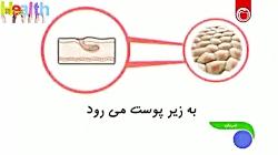 آشنایی علائم درمان بیماری گال