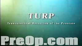 پروستات بازسازی ترورترال TURP طریق جراحی آلت تناسلی