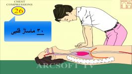 احیای قلبی ریوی  Cardiopulmonary Resuscitation  CPR