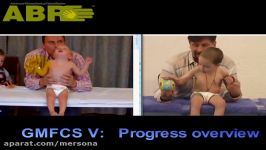 ABR CP Child Development Progress Overview  Quadriplegic Cerebral Palsy Child