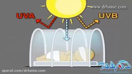 مقایسه روشهای فوتوتراپی در درمان زردی نوزادان