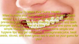 How To Make Your Gums Healthy  Useful info