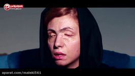 اسیدپاشی وحشیانه روی عروس ایرانی؛ چشم هایی پای کینه پدرشوهر سنگ دل کور شدند ا