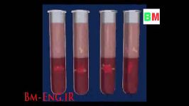 بررسی روشهای تعیین گروه خونی مهندسی پزشکیBm Eng.iR
