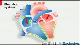 پیس میکر Pacemaker