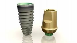 Restoring dental implants BioHorizons