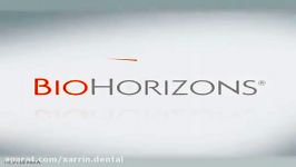 Laser Lok Technology Animation biohorizons