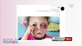 دختر شش ساله یمنی احساسات مردم دنیا را جریحه دار کرد