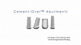 MDL Cement Over Titanium Abutment System 1