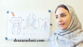 فیلم گیتس گلیدن در روت کانال تراپی درمان ریشه دندان