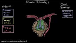 Diabetic nephropathy  Clinical presentation treatment  NCLEX RN  Khan Academy