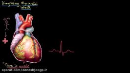 Heart attack myocardial infarct diagnosis  NCLEX RN  Khan Academy