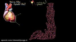 Healing after a heart attack myocardial infarction  NCLEX RN  Khan Academy