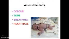 Neonatal Resuscitation