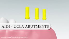 تکنیک قالبگیری کلوزتری UCLA